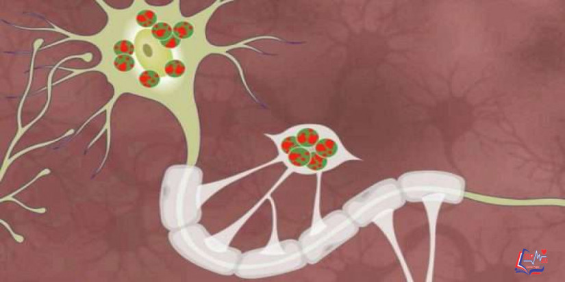 مرض كرابي Krabbe disease