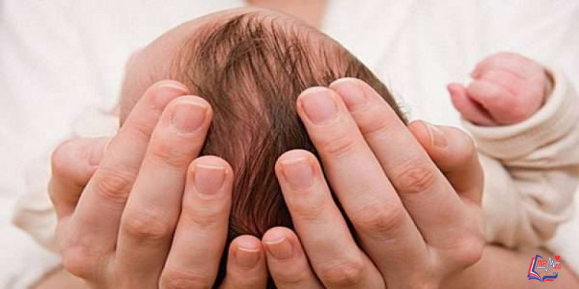 تعظم الدروز الباكر Craniosynostosis