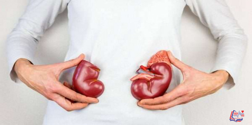 خلل التنسج الكلوي kidney dysplasia