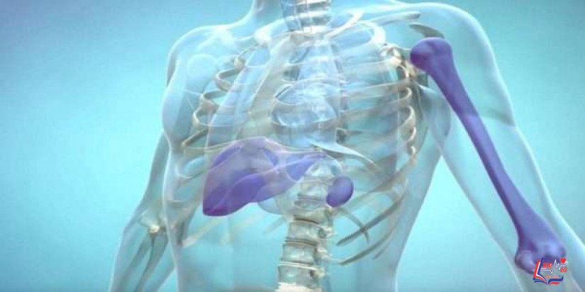 مرض جوشر Gaucher disease