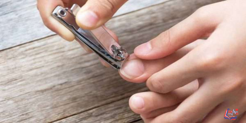 الظفر الناشب في القدم  Ingrown-toenail