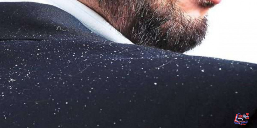 قشرة الرأس الزهمي