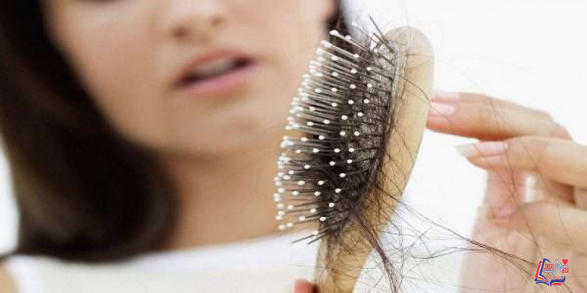 سقوط الشعر Hair loss