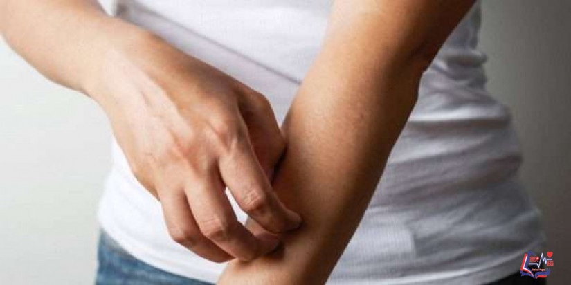 القوباء الحلقية في الجسم Body Ringworm