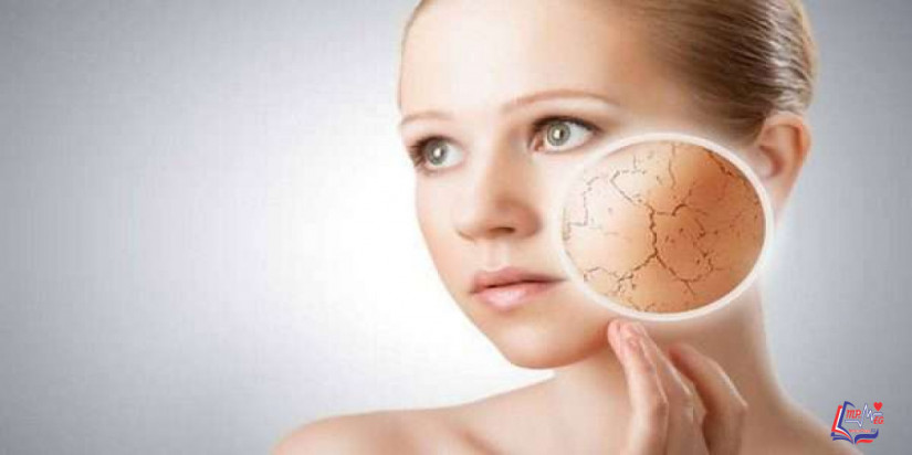 جفاف الجلد Dry skin