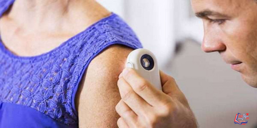 الأكياس Cysts