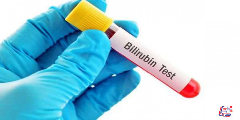 متلازمة جيلبرت Gilberts syndrome