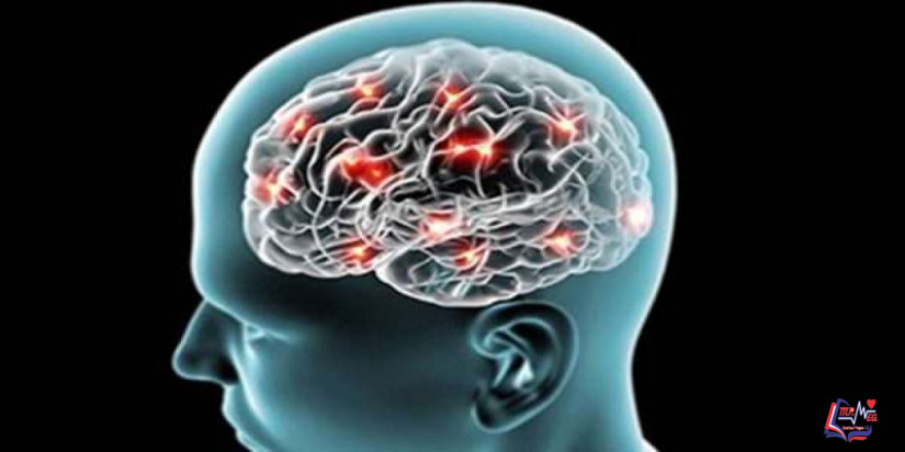 الناسور الشرياني الوريدي السحائي Dural arteriovenous fistulas