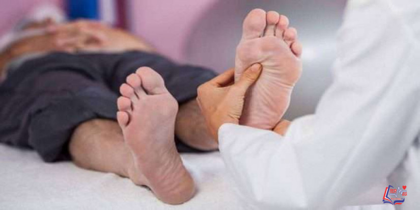 مرض شاركوت ماري توث Charcot Marie Tooth disease