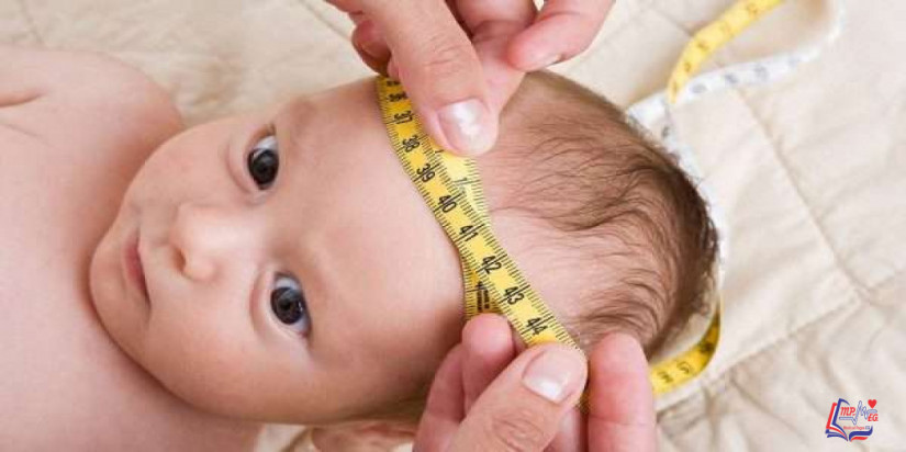 استسقاء الرأس  Hydrocephalus