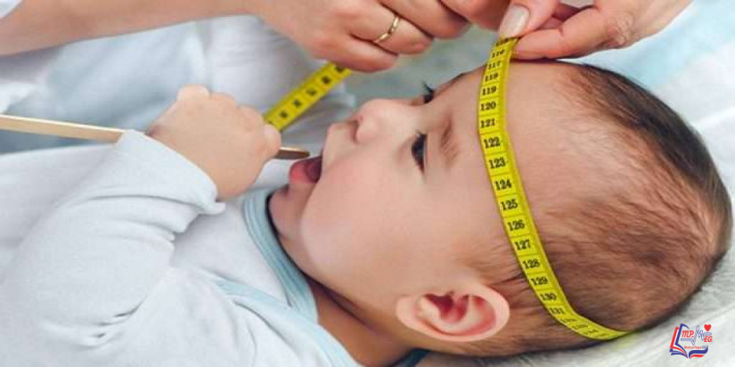 مرض كانافان Canavan disease