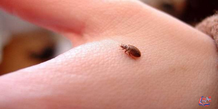 حساسية عث الغبار Dust Mite Allergy