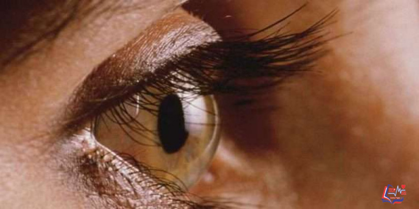 اعتلال الشبكية السكري Diabetic retinopathy