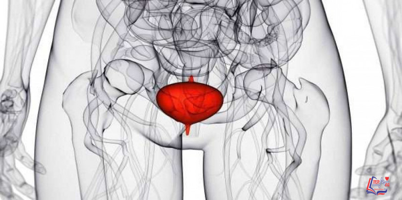 سرطان المثانة Bladder cancer