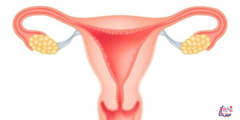 سرطان المبيض Ovarian cancer