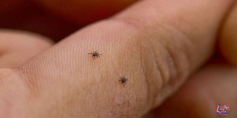 مرض لايم lyme disease