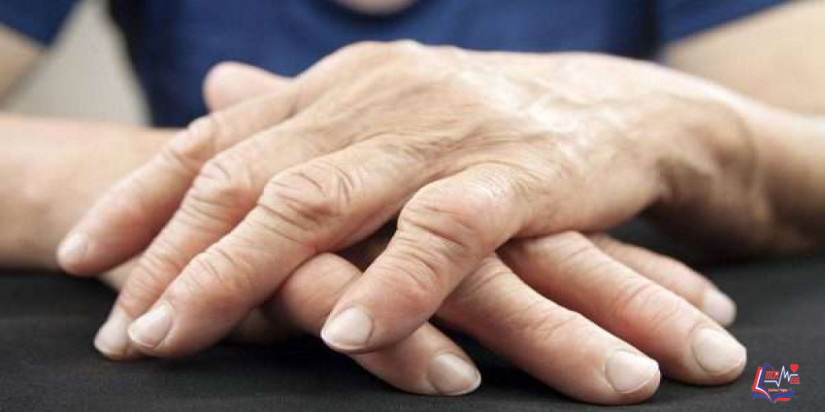 النقرس الكاذب Pseudogout