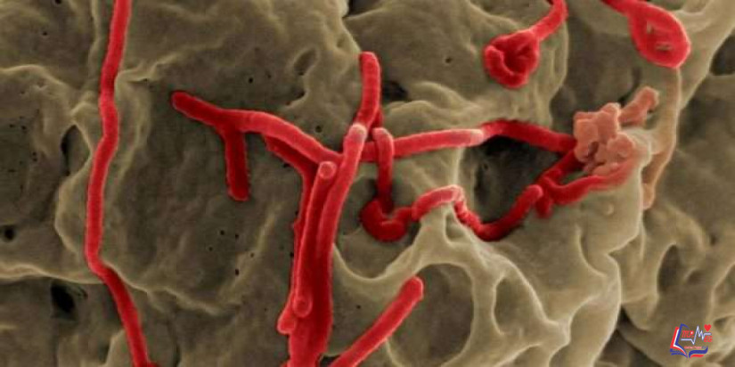 الحمى النزفية للإيبولا Ebola hemorrhagic fever