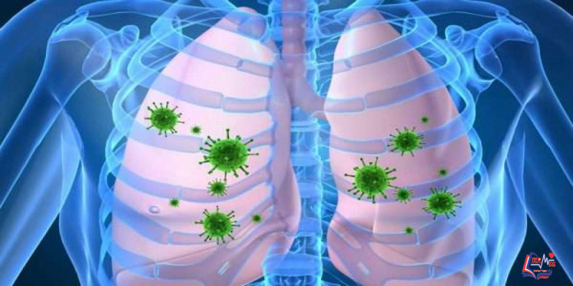 فيروس هانتا HPS) Hantavirus)