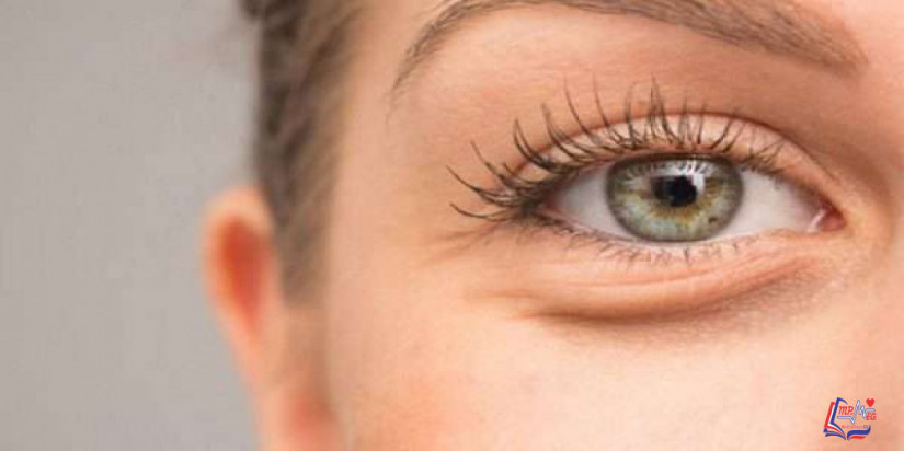 انتفاخات تحت العين Bags under eyes