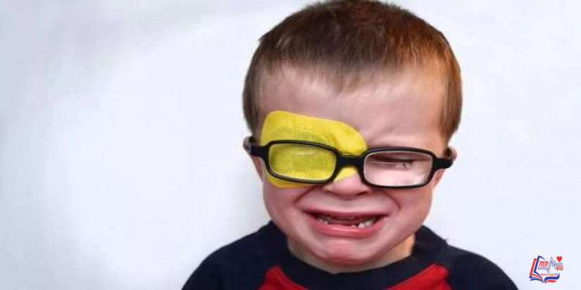 العين الكسولة Lazy eye